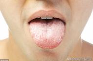 舌头变成白色是什么原因（和这5个原因有关）